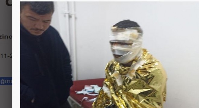 Kömür ocağında yangın: 2 işçi yaralı